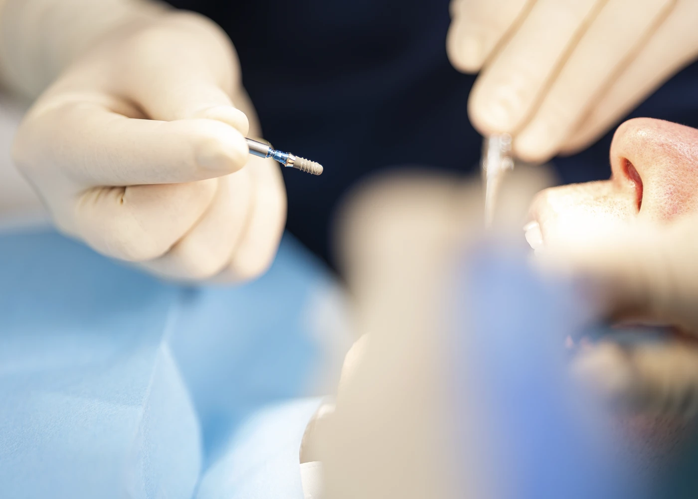 Zahnarzt bei Implantatbehandlung in der Praxis Dr. Schmutz, Villingen-Schwenningen.